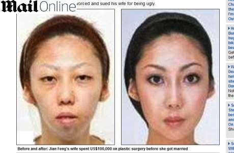 A mulher de Jian Feng sofreu essa transformação depois das plásticas