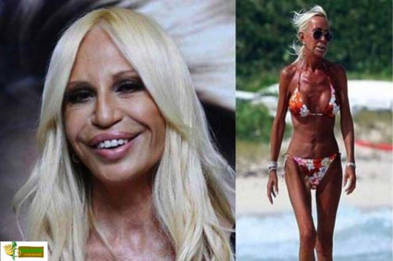  Пластические операции 500 лет назад. Ужасы в картинках. 