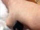 Sabe como foi que isso aconteceu? O rapaz deixou a chave do carro dentro daquele bolso da perna, na calça de seu quimono. Durante a aula, ele caiu com o pé sobre a chave e acabou desse jeito. 