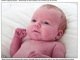 

O recém-nascido Danny Davies, que mora em Felphamm, na Inglaterra, foi diagnosticado com
problema cardíaco letal depois que seus pais perceberam, em algumas fotos, que
o menino estava com a ‘pele roxa’