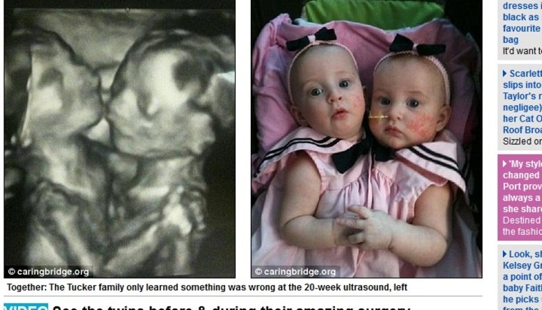 Reprodução/ Daily Mail