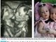 Allison June e Amelia Lee Tucker se desenvolveram 'grudadas' pelo peito desde quando estavam no útero da mãe, segundo o site do jornal Daily Mail