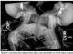 Um exame de raio X mostrou com mais detalhes o 'problema' das gêmeas siamesas e indicava o quão difícil seria a cirurgia para separá-las