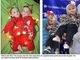 Allison June e Amelia Lee Tucker se desenvolveram <a href="http://noticias.r7.com/saude/fotos/medicos-levam-sete-horas-para-separar-gemeas-siamesas-em-cirurgia-21122012?foto=1#fotos">'grudadas' pelo peito</a> desde quando estavam no útero da mãe, segundo o site do jornal Daily Mail. Aos nove meses, elas foram submetidas a uma cirurgia para separá-las. A intervenção durou sete horas, mas foi bem-sucedida