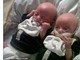 O caso revoltou a mãe dos gêmeos Mason (esquerda) e Reece, Sarah Fellows. Sarah recebeu um telefonema informando que seu filho prematuro, de apenas quatro meses, estava com uma chupeta grudada em sua boca com fita cirúrgica. O bebê precisava lutar para respirar com o objeto em sua boca