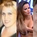 Mortes na mesa de cirurgia pl&aacute;stica assombram o Brasil; veja casos ...