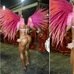 Bumbum desfigurado de Gracyanne gera pol&ecirc;mica e Nana Gouv&ecirc;a ...