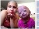 

Com seis milhões de fãs no Facebook,
Adalia Rose, de seis anos, surgiu aos olhos do público devido a uma condição
rara de envelhecimento precoce