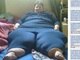 Sophia Loots, cujas pernas gigantescas fizeram com que vivesse como prisioneira em sua cama durante cinco anos, está pronta para andar novamente depois de conseguir drenar o excesso de líquido em suas pernas<br>