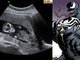 E o filho do Venom, como é que vai chamar? Venoninho?