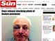 

Um aposentado de 78 anos (foto) foi atacado em uma estrada no sudeste
de Londres, por volta da meia noite, no dia 15 de outubro do ano passado.
<br><br>Segundo o tabloide britânico The Sun, <a href="http://noticias.r7.com/internacional/idoso-de-78-anos-fica-desfigurado-apos-assalto-em-londres-15112012">o assalto aconteceu na
estrada Widmore</a>, na região metropolitana de Londres. <br><br>Dois adolescentes, um homem de 18 anos e uma mulher de 19
foram presos, acusados de ter conexão com o caso