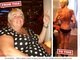 A britânica Julie Dunbar, 51 anos, passou dos 127 kg para 38,1 kg depois de uma cirurgia gástrica e agora é obrigada a consumir 5 mil calorias diárias para se manter viva<br>