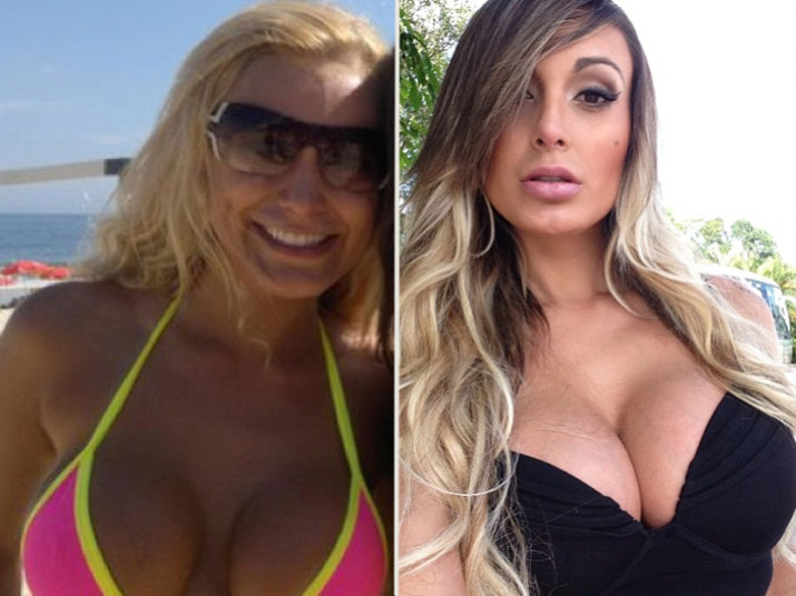 Dona de um corpão de causar inveja, a vice-miss Bumbum e participante de A Fazenda Andressa Urach parece não ter do que reclamar. A gata jura ter conquistado um dos homens mais cobiçado do mundo, o jogador de futebol Cristiano Ronaldo. Mas, mesmo com tanto marmanjo suspirando por sua beleza, Andressa ainda acha que pode ficar melhor. Veja na galeria acima as plásticas que a beldade já fez e as que gostaria de fazer