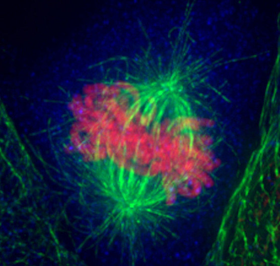 Em termos de riscos biológicos, ele se preocupa com boas intenções mal aplicadas, como experimentos visando promover modificações genéticas e reconstruir estruturas genéticas. Leia também: cientistas fotografam doenças mortais com microscópios de alta resolução