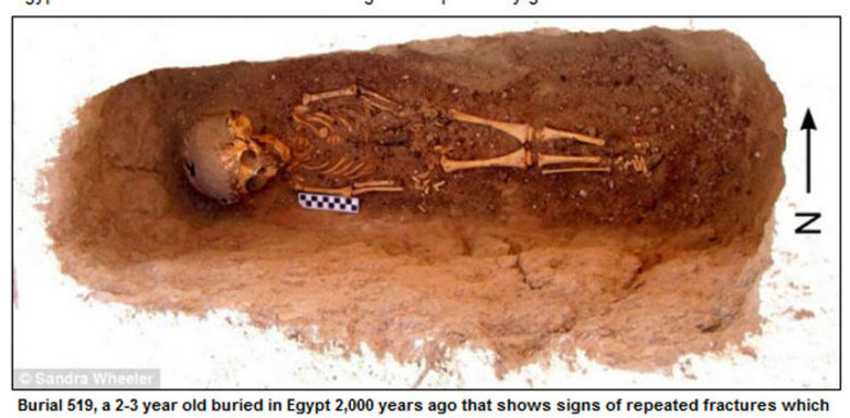

Arqueólogos encontraram no deserto
de Dakhla, no Egito um fóssil que deve render muito estudo: uma criança de 2 a
3 anos, de 2.000 anos atrás, com sinais de que teve seus ossos quebrados e que
foi “chacoalhada” diversas vezes

