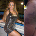 Corajosas! Famosas mostram o rosto e o corpo logo ap&oacute;s cirurgias ...
