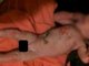 Equipes de regate salvaram na madrugada do dia 23 de junho um
recém-nascido que estava preso dentro de um cano em Alicante, na Espanha. A
criança, ainda com o cordão umbilical, foi encontrada dentro de um saco
plástico com um buraco para respirar.

De acordo com o tabloide inglês
The Sun, a mãe do bebê, de 26 anos, foi presa por suspeita de tentativa de
assassinato. Ela alega que cometeu o crime por não ter dinheiro para fazer um
aborto, prática legalizada na Espanha.

Segundo os policiais, antes de
cometer o crime, ela tinha se internado no hospital no dia 21 do mês dizendo
ter sofrido um aborto espontâneo.

O
recém-nascido de 2,1 kg foi encaminhado para o hospital com um braço quebrado e
ferimentos no corpo. Apesar do estado grave de saúde, os médicos disseram que
ele não corre o risco de morrer