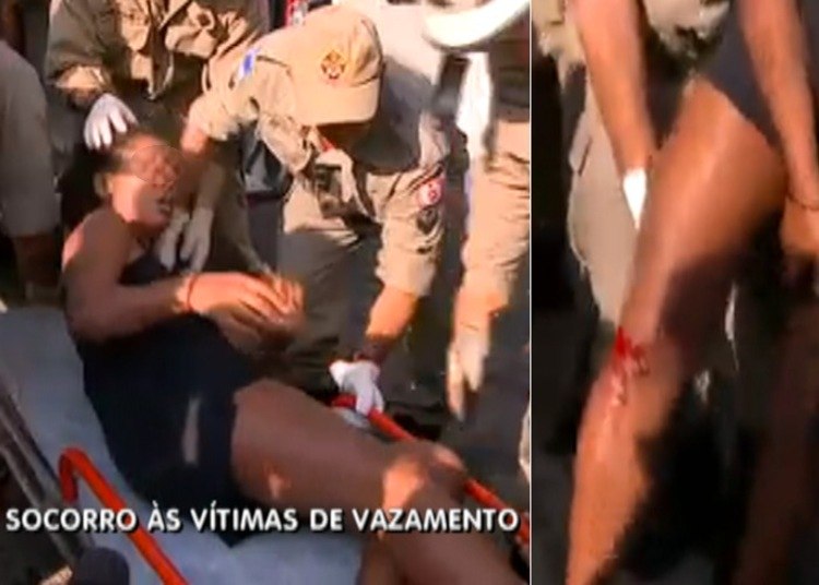 Bombeiros resgatam uma mulher ferida; à direita, o ferimento que ela sofreu na perna 