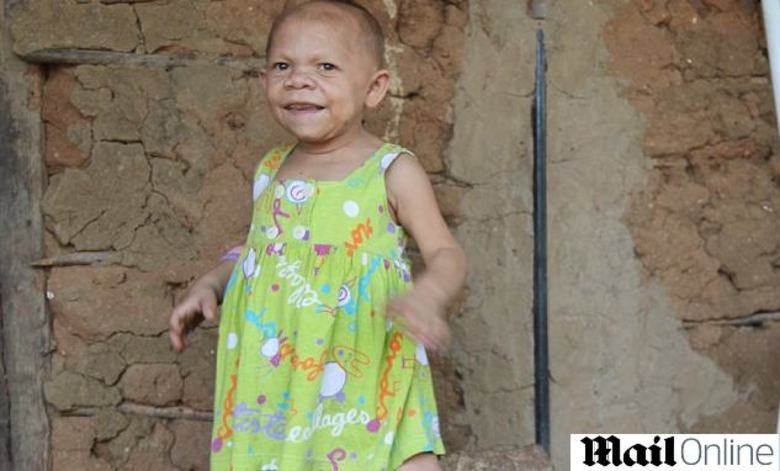 Uma brasileira de 31 anos virou personagem de uma série
médica americana chamada 40 Years-Old Child, que será exibida dia 19 de agosto no canal TLC, e contará a história de pessoas que têm problemas com o envelhecimento precoce.Mesmo com três décadas de vida, ela tem aparência de criança, como acontece no filme O Curioso Caso de Benjamin Button, que relata a história de um bebê que nasce com a aparência de um idoso de 80 anos. As informações são do Daily Mail
