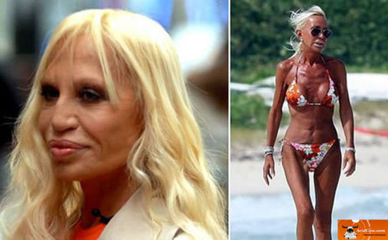 A estilista Donatella Versace entende tudo de moda. Já de aparência...