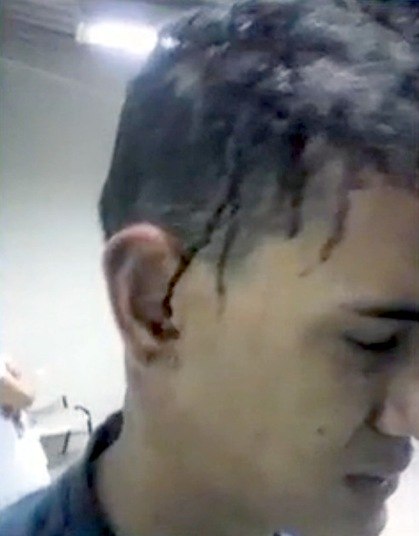 Um jovem de 18 anos diz ter sido espancado pelo pai com um
pedaço de madeira, no Recreio dos Bandeirantes, zona
oeste do Rio de Janeiro. Diego Martins contou que o pai o acordou, dizendo que
ele estava usando drogas. Apesar de o menino negar, o homem começou a agredi-lo. O caso ocorreu no último dia 25