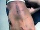 O jovem sofreu ferimentos por todo o corpo