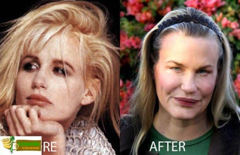 Moça, você não parece mais jovem... você parece uma velha com a cara esticada