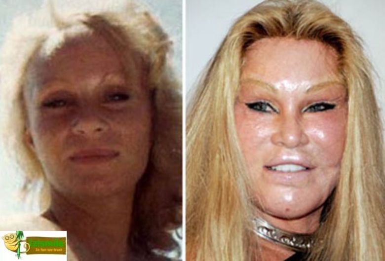 Tá tão esticada que parece que vai estourar, como uma bexiga