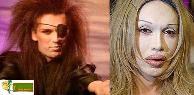 Ainda bem que o olho, pelo menos, voltou a ficar bom.