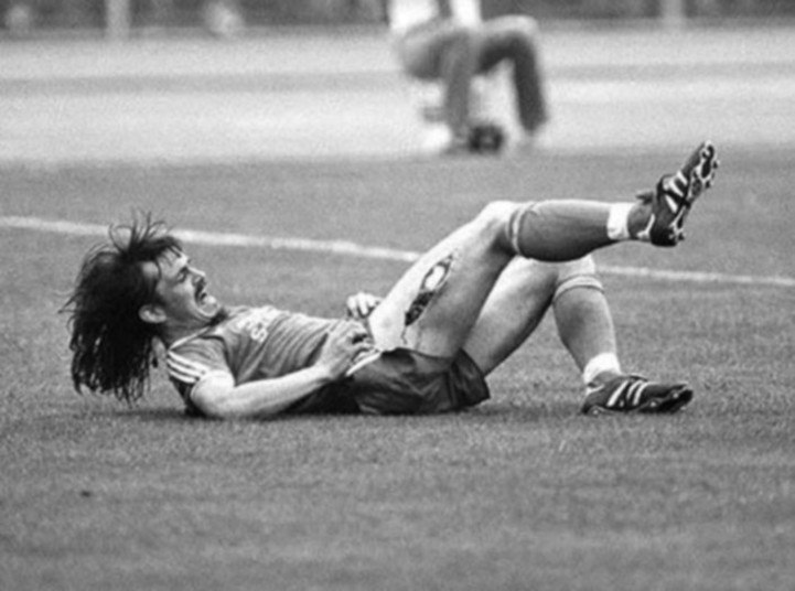 Em 1981, na Alemanha, quando jogava pelo Arminia Bielefeld, Eowald Lienen sofreu uma terrível lesão, apesar de não ter quebrado nada. Após duro carrinho de Norbert Siegmann, do Werder Bremen, teve sua coxa rasgada, expondo o tecido e o osso do jogador