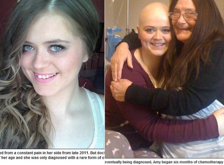 A jovem britânica Amy Quinn, de 20 anos, lamenta ter ficado estéril por conta do atraso do diagnóstico de câncer de ovário. Os médicos demoraram um ano para descobrir a doença, que já tinha se espalhado e obrigou a moça a remover os ovários, as trompas de falópio e o apêndice. As informações são do Daily Mail desta quarta-feira (16)Sexo oral causa mais câncer de garganta que cigarro e álcool