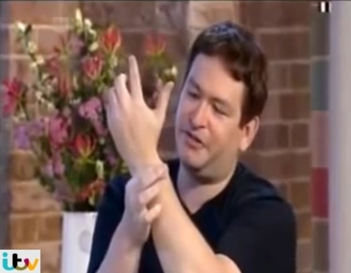 Você já se imaginou tendo um problemão deste tamanho? 34cm é o tamanho que tem o pênis de Jonah Falcon, considerado o maior do mundo. Em um programa de TV ele contou mais sobre sua vida e o efeito da recente famaSegundo ele, o negócio tem mais ou menos essa largura aí em cima