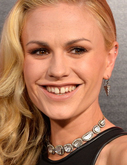 Anna Paquin, de X-Men e da série True Blood, tem uma leve separação entre os dois dentes da frente e uma pele pra lá de imperfeita. Nem parece que é uma das atrizes mais famosas entre as séries de filmes americanos