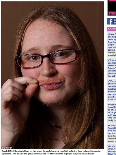 

Depois
de ficar satisfeita com a reação das pessoas ao ver a sua aparência, Sarah O’Neill,
de 29 anos, resolveu deixar o bigode crescer. A mulher sofre de uma doença que provoca
o crescimento excessivo de pelos na região do rosto. As informações são do site Daily MailFamília com 'síndrome do lobisomem' passa por tratamento
