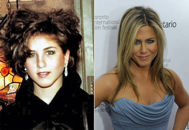 Jennifer Aniston afinou o nariz depois que despontou em Friends