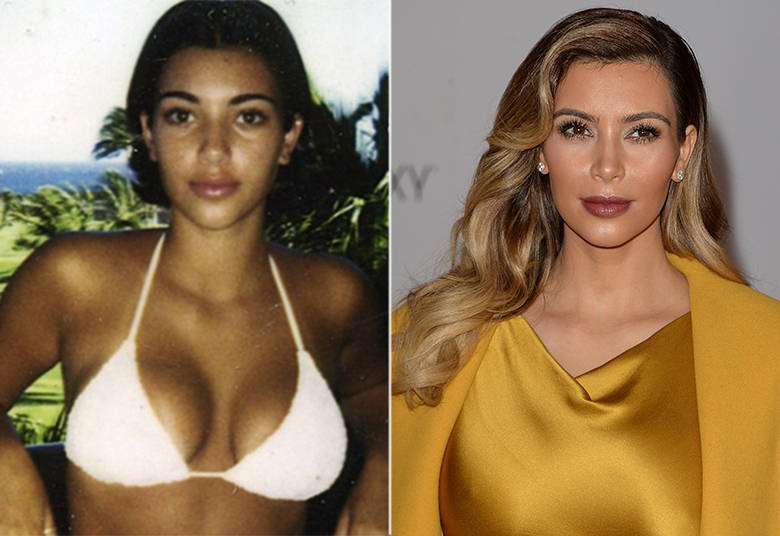 Kim Kardashian, por exemplo, afinou o nariz, mudou drasticamente o desenho da sobrancelha e depilou até a testa para modificar o contorno do rosto