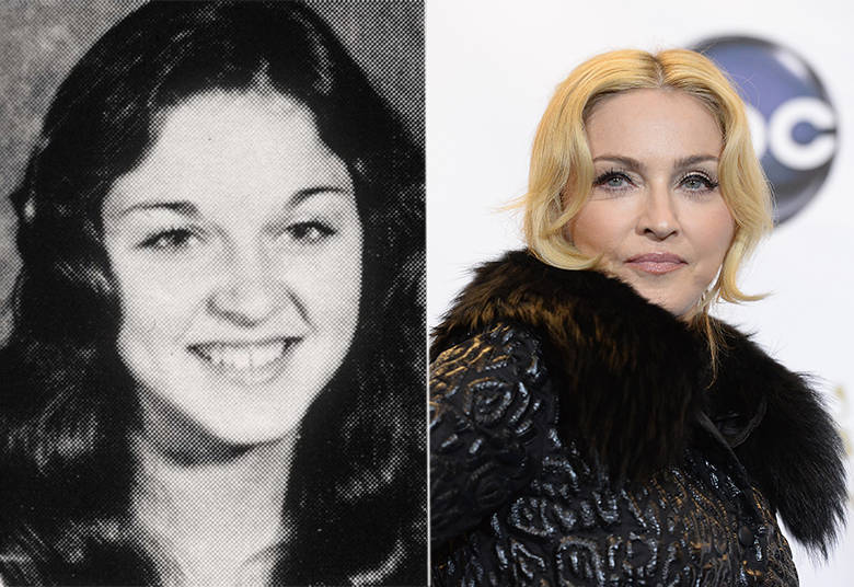 Madonna tinha outro nariz antes de virar uma diva do pop. E, recentemente, investiu nas aplicações de botox