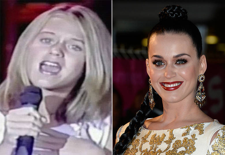 Katy Perry diz que não fez plástica alguma, mas é inegável que seus lábios aumentaram e o queixo mudou