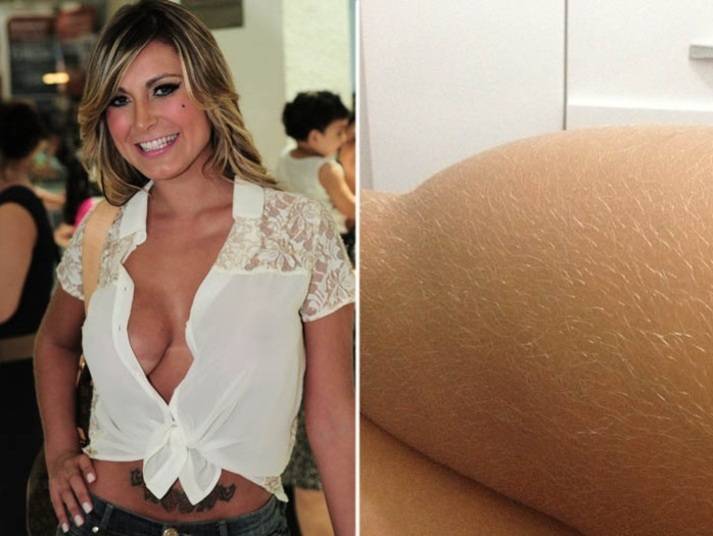 Andressa Urach faz o mesmo e exibe por aí fios loirinhos, loirinhos nas pernas