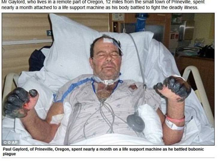 O
aposentado Paul Gaylord, 61 anos, contraiu uma doença rara, conhecida como peste
bubônica (peste negra), após ser mordido por um gato de rua, em Oregon, nos
Estados Unidos. As
informações são do site Daily Mail