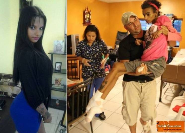 A jovem Linda Perez, 18 anos de idade, entrou em coma em agosto do ano passado após fazer uma cirurgia para aumentar o tamanho de seus seios. A jovem já está em casa, mas ainda é incapaz de se mover por conta própria e só consegue dizer algumas palavras. As informações são do site Daily MailErro médico: jovem de 19 anos fica estéril após descobrir câncer A jovem Linda Perez, 18 anos de idade, entrou em coma em agosto do ano passado após fazer uma cirurgia para aumentar o tamanho de seus seios. A jovem já está em casa, mas ainda é incapaz de se mover por conta própria e só consegue dizer algumas palavras. As informações são do site Daily MailErro médico: jovem de 19 anos fica estéril após descobrir câncer