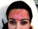 Kim Kardashian queria ficar bonita, mas antes acabou ficando bizarra. Ela postou uma foto de um tratamento facial que deixa o rosto cheio de sangue, é um lifting apelidado de vampiro. Credo!