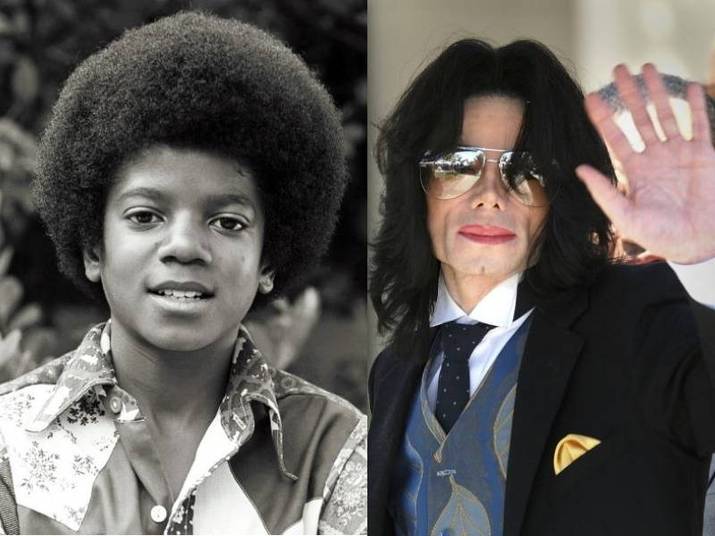 Com a chance de Michael Jackson estar vivo, especula-se que o cantor possa estar disfarçado no meio de nós. Para isso, ele poderia pensar em alterar alguns pontos bastante marcantes de seu visual como os cabelos e o nariz. Mas será que ele poderia fazer novas plásticas? O R7 foi atrás de um cirurgião plástico para responder essa pergunta*Colaborou Rebeca Tosta, estagiária do R7