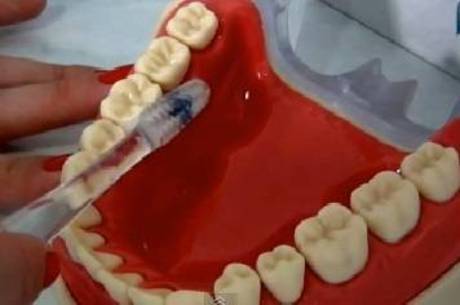 Especialista dá dicas de como escovar os dentes da forma correta