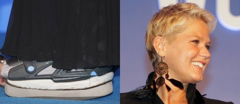 Pé de Xuxa com bota ortopédica e curativo