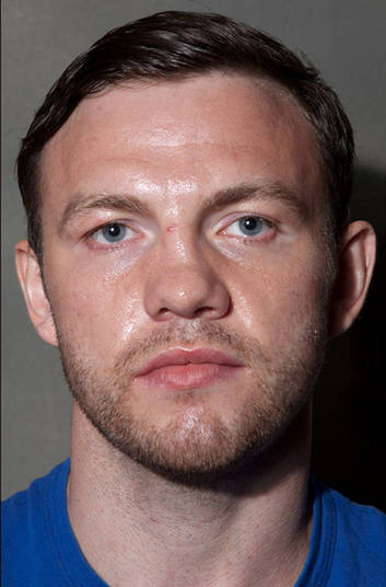 O boxeador Andy Lee é da categoria dos pesos médios, será que ele vai ser o mais desfigurado dessa turma de lutadores? O boxeador Andy Lee é da categoria dos pesos médios, será que ele vai ser o mais desfigurado dessa turma de lutadores?