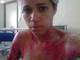 A moça se lembra dos momentos de terror que viveu.— Os meus olhos foram atingidos, os meus braços e uma das minhas pernas. Eu cheguei a gritar por socorro, porque teve um momento que eu não conseguia ver mais nada”, lembra. Veja na reportagem!