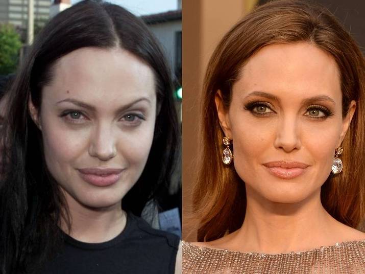 O mesmo acontece com Angelina Jolie. A atriz, que é referência de beleza, já usou as sobrancelhas bem mais finas