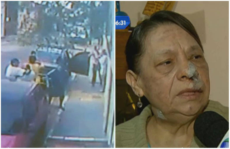 Uma rixa de 20 anos entre vizinhos quase terminou com a morte de uma idosa de 67 anos. A mulher foi esfaqueada pela vizinha e levou 40 pontos no rosto e dez no pescoço