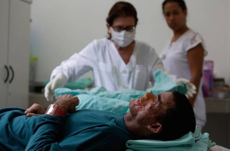 

A
doença de pele é conhecida como xeroderma pigmentoso, ou 'XP'